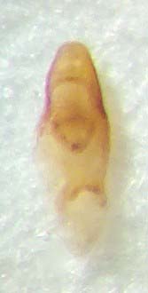 Medon.umbilicatus.Aed.links