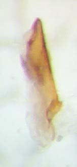 Medon.umbilicatus.AedLat.links