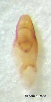 Medon.umbilicatus.Aed.links